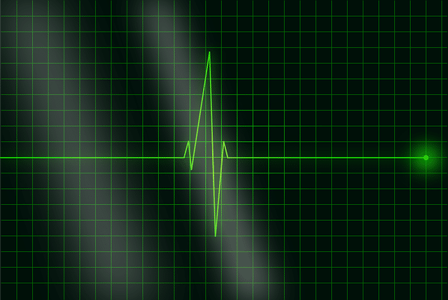 Alsem of Vergif zit in de dosis: aan elkaar_foto electrodiagram